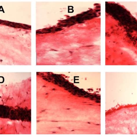 Histological Sections Of 3d Tissue Engineered Oral Mucosa Models After