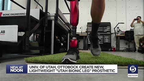 The U Unveils Worlds Most Advanced Bionic Leg Youtube