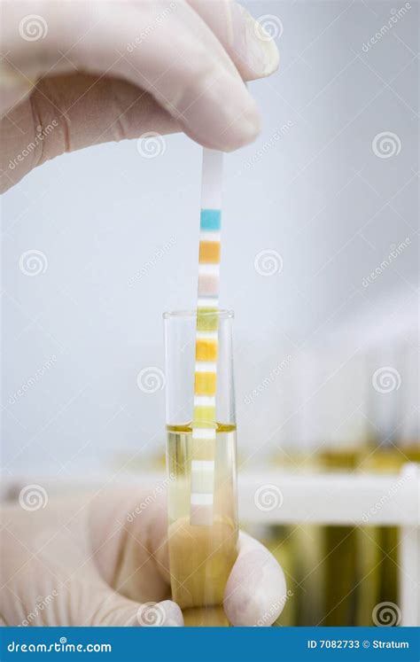 Urine Sample Stock Image Image Of Immersion Laboratory 7082733