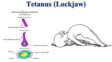 Tetanus Bacteria Life Cycle