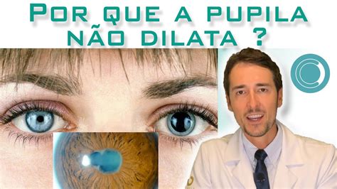 É normal não conseguir dilatar a pupila YouTube