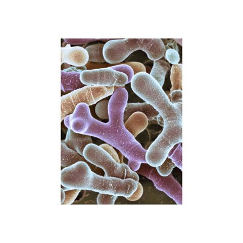 Bifidobacterium animalis (500 billion/g) (Freeze-dried)