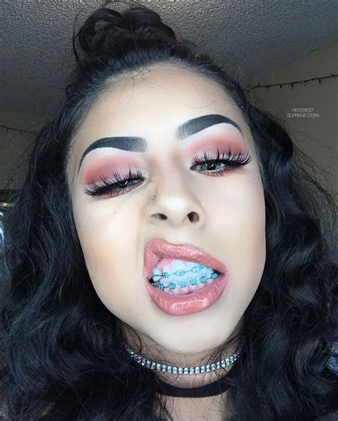 Pinterest Supreme Cora🎭 Brace Face Cute Braces Cute Girls With Braces