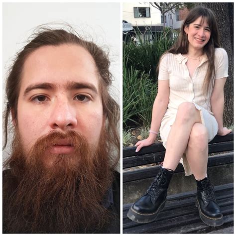 30 Yo Mtf 8 Months Hrt R Transtimelines