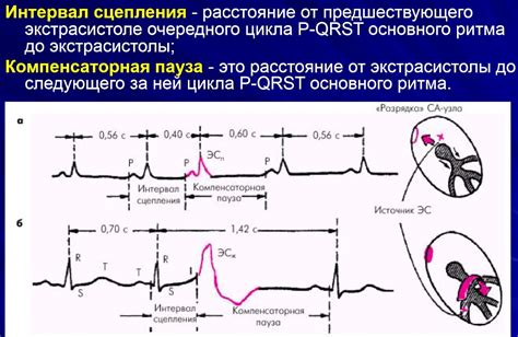 Экг Как Часто Можно Делать - 57 Фотo