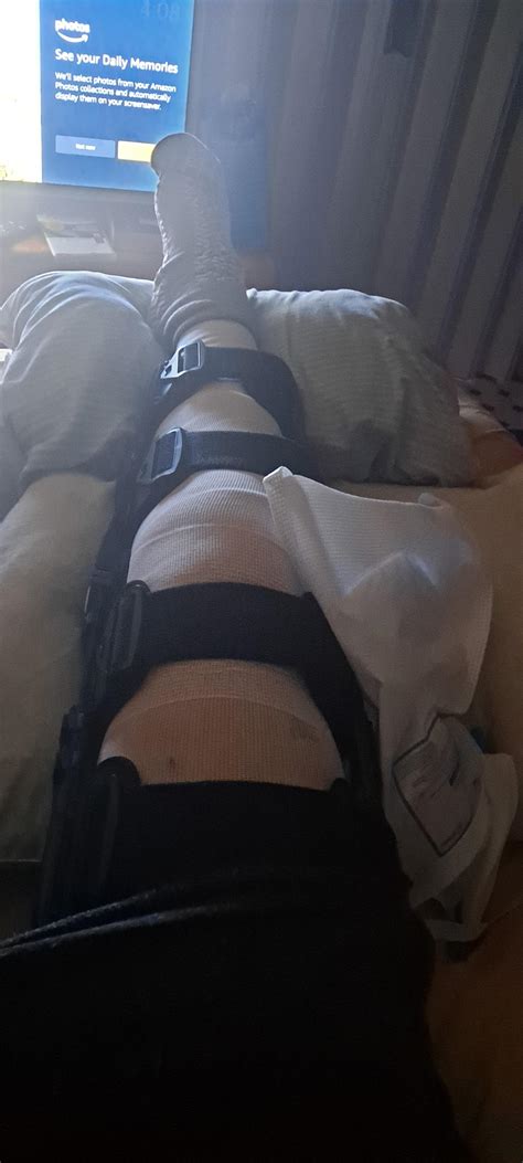 hey I got a major surgery on my knee today. can't find the bloody name