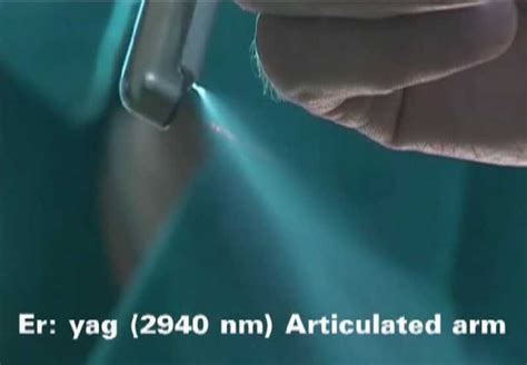 Laser | dental surgery clinic serbia