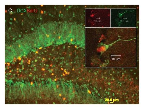 Microlesion Stimulates Neurogenesis A Merged Image Of Dcx And Brdu