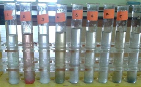 Estimation Of Protein By Lowrys Method Download Scientific Diagram