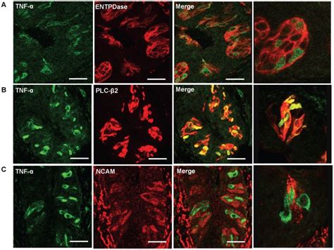 Confocal Images Of Double Immunofluorescent Staining Of Tnf Green