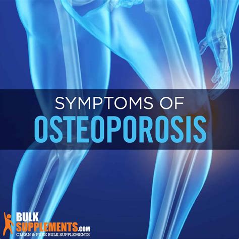 Osteoporosis Symptoms Causes And Treatment