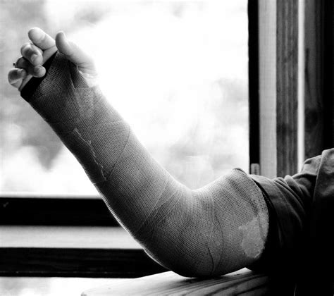 How Do I Treat A Broken Elbow With Pictures