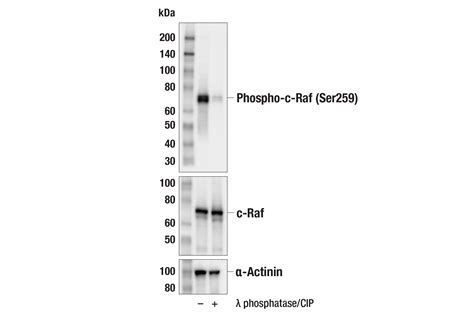 Phospho C Raf Ser259 E7Z7H Rabbit MAb Cell Signaling Technology