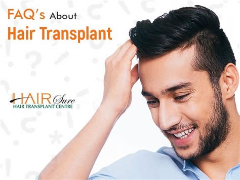 Faqs About Hair Transplant Cyber Hairsure