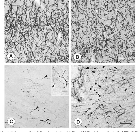 Figure From Beta Amyloid Induced Cholinergic Lesions In Rat