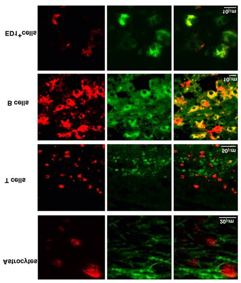 Immunohistochemical Colocalization Of Nerve Growth Factor Ngf And