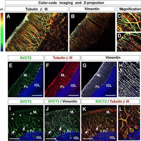 Svct2 Expression And Adult Cerebellar Cortex Architecture Ad Deep Download Scientific Diagram