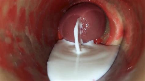 Camera Inside Deep Pussy Captures Huge Ejaculation Of Sperm Asmr XHamster