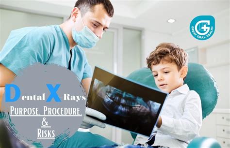 Dental X Rays Purpose Procedure And Risks Milani Dentistry