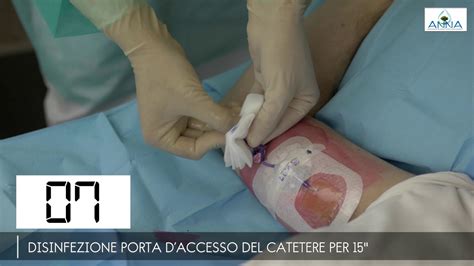 Medicazione Picc E Gestione Della Linea Infusionale Youtube