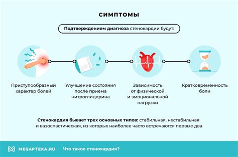 Стенокардия симптомы и лечение, диагностика: Клинические рекомендации