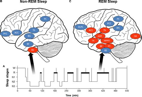 A Hypnogram Schematic Representation Of Normal Sleep Organization