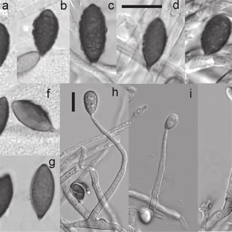 Gliomastix Fusigera Based On Culture Obtained From Single Ascospore