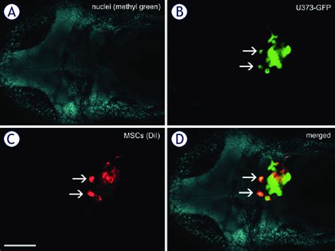 Fusion Between Gbm Cells And Mscs In The Zebrafish Brain A Mixture Of