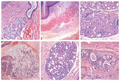 Esophageal Glands Histology