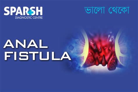 Anal Fistula Sparsh Diagnostic Center