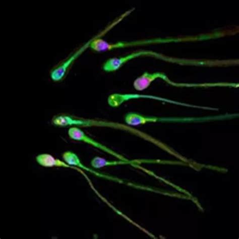 Artificial sperm created - Chronicle Live