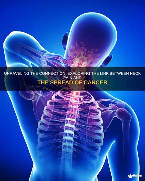 Unraveling The Connection Exploring The Link Between Neck Pain And The Spread Of Cancer Medshun