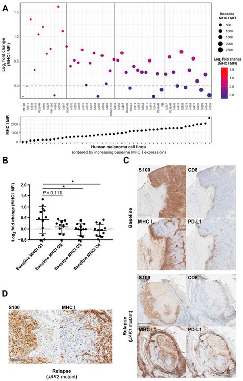 MHC I expression of human melanoma exhibits IFN γ dependence A