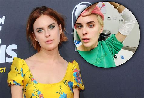 Tallulah Willis Undergoes Painful Tattoo Removal: ‘I was 20 and Impulsive’