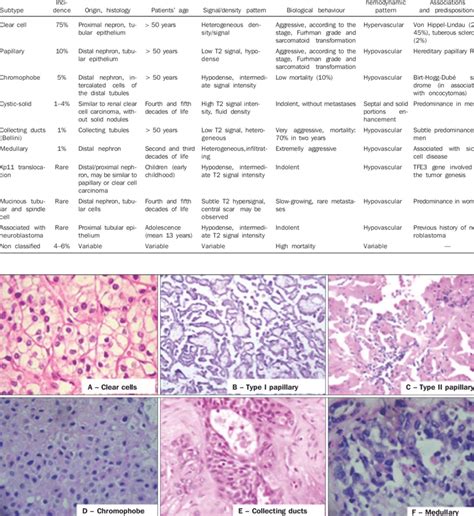 Renal Cell Carcinoma Histology