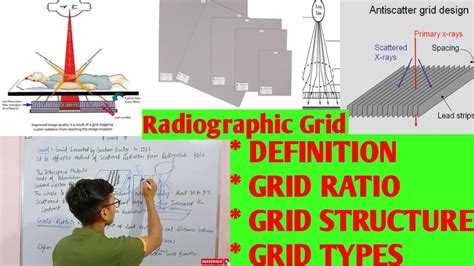 Radiographic Grid Scatter Grid Grid In Radiology Grid Ratio Grid