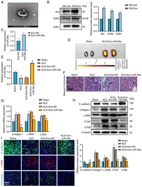 Exosome‑encapsulated Mir‑26a Attenuates Aldosterone‑induced