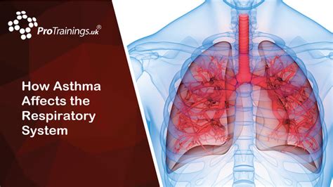 How Asthma Affects The Respiratory System Asthma Awareness Level