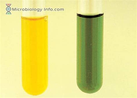 Biochemical Test Archives Microbiology Info