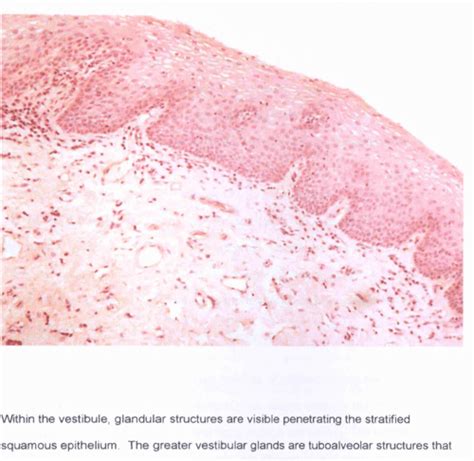 Figure 1 1 From Vulval Vestibulitis Syndrome Semantic Scholar