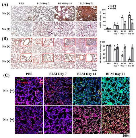 Ijms Free Full Text Nintedanib Inhibits Endothelial Mesenchymal