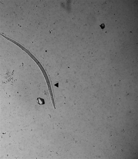 Larvicidal Effect Of Protein Extract Preparations The Arrow Indicates