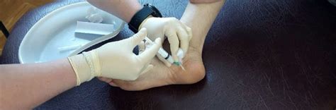 Блокада при пяточной шпоре в Казани - Клиника НативаМед