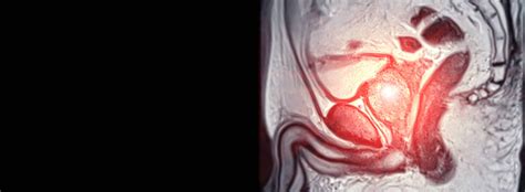 Comment Se Passe Une Irm Des Voies Urinaires Radiologie Révélis
