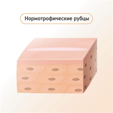 Имофераза крем от шрамов, рубцов, растяжек и пигментации, без отдушек и ...