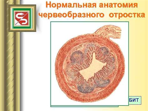 ОСТРЫЙ АППЕНДИЦИТ Нормальная анатомия червеобразного отростка ТАЗОВОЕ