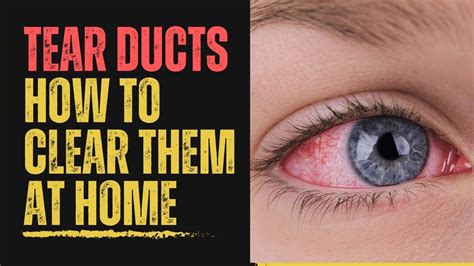 How To Treat Blocked Tear Ducts At Home Remedies Tips And Prevention Youtube