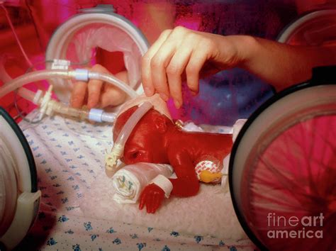 Premature Baby Photograph By Simon Fraser Princess Mary Hospital