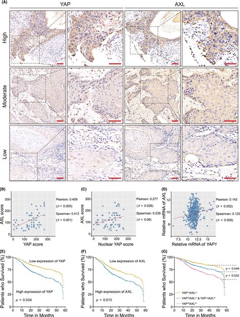 A Positive Correlation Between Yesassociated Protein YAP And AXL Is