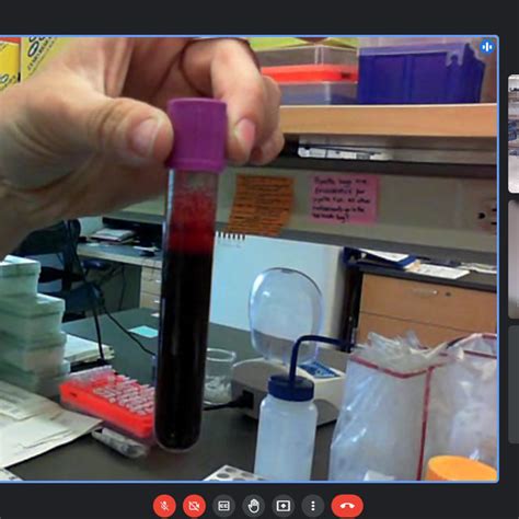 The Uf Dr Brooks Equine Genetics Lab Demonstrates Dna Extraction